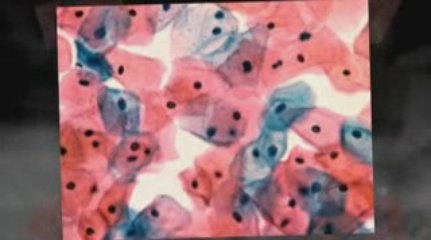 High Point, NC Mesothelioma Lawyer