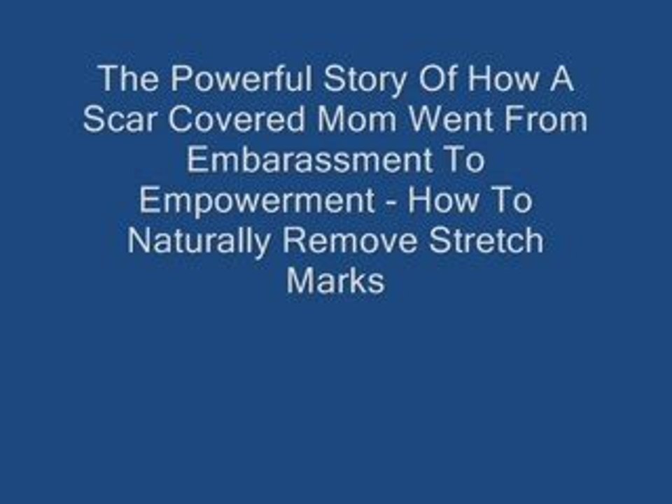 Preventing Stretch Marks For Ever