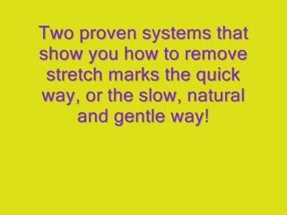 Natural Ways of Removing Stretch Marks