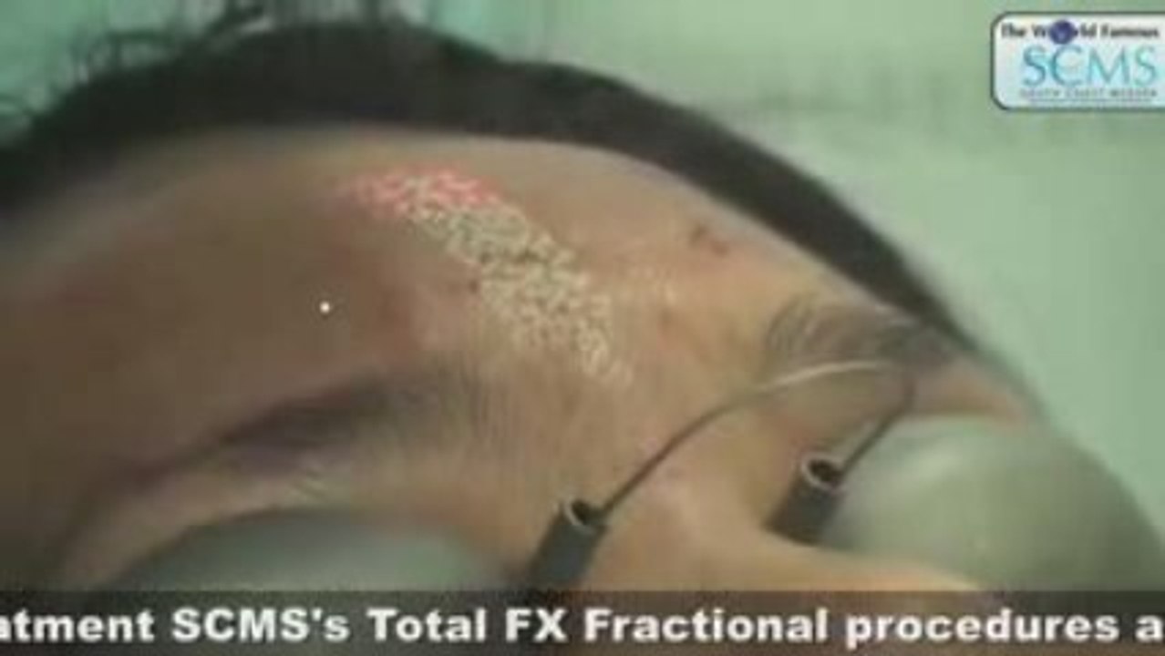 FX Profractional