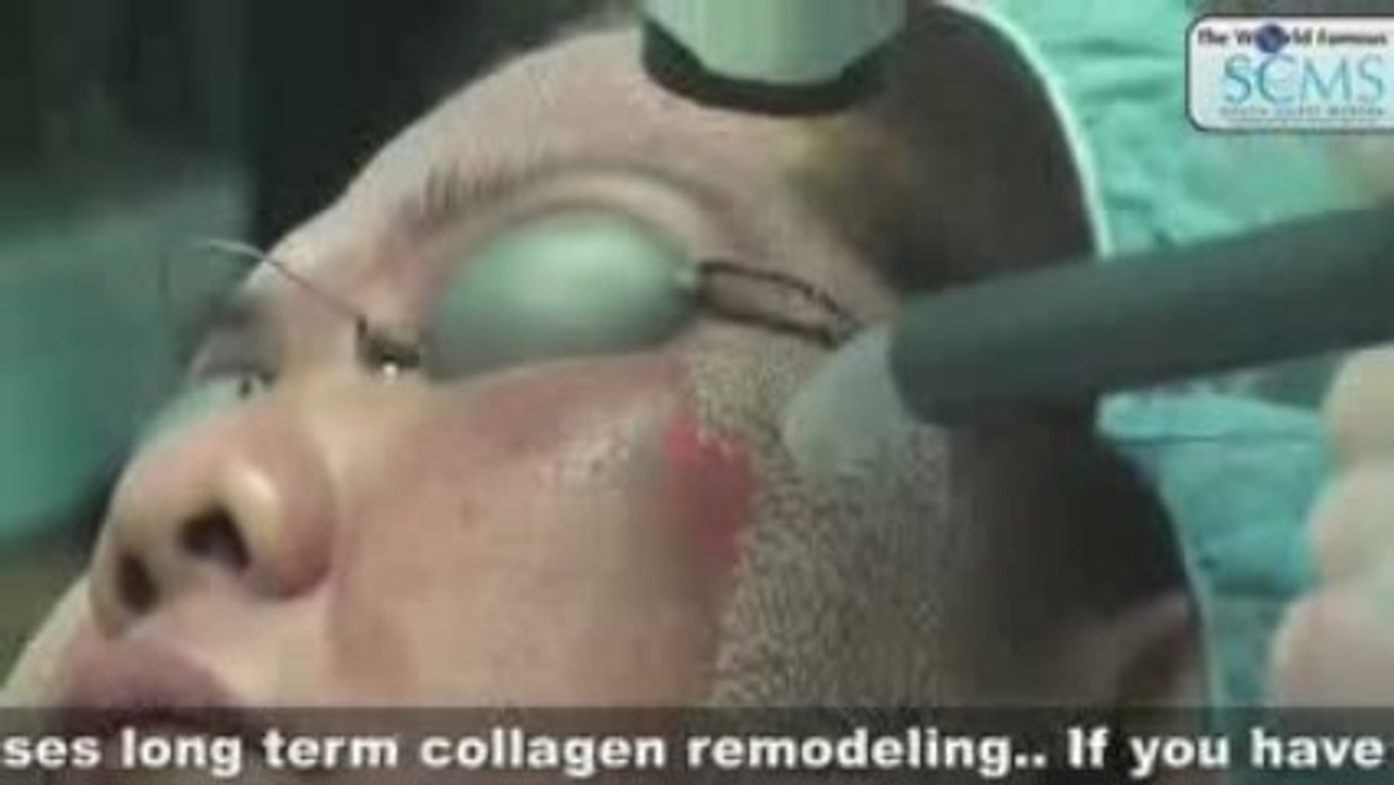 FX Profractional