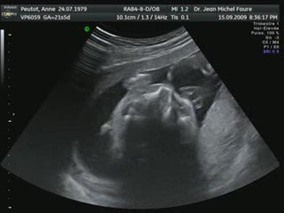 bb2010