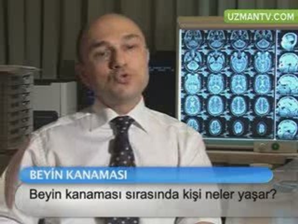 Beyin kanaması sırasında kişi neler yaşar?