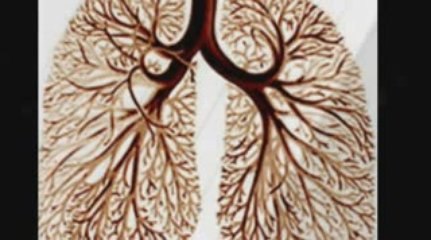 Knoxville, TN Mesothelioma Lawyer