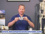 Spinal Decompression Therapy Centennial Colorado