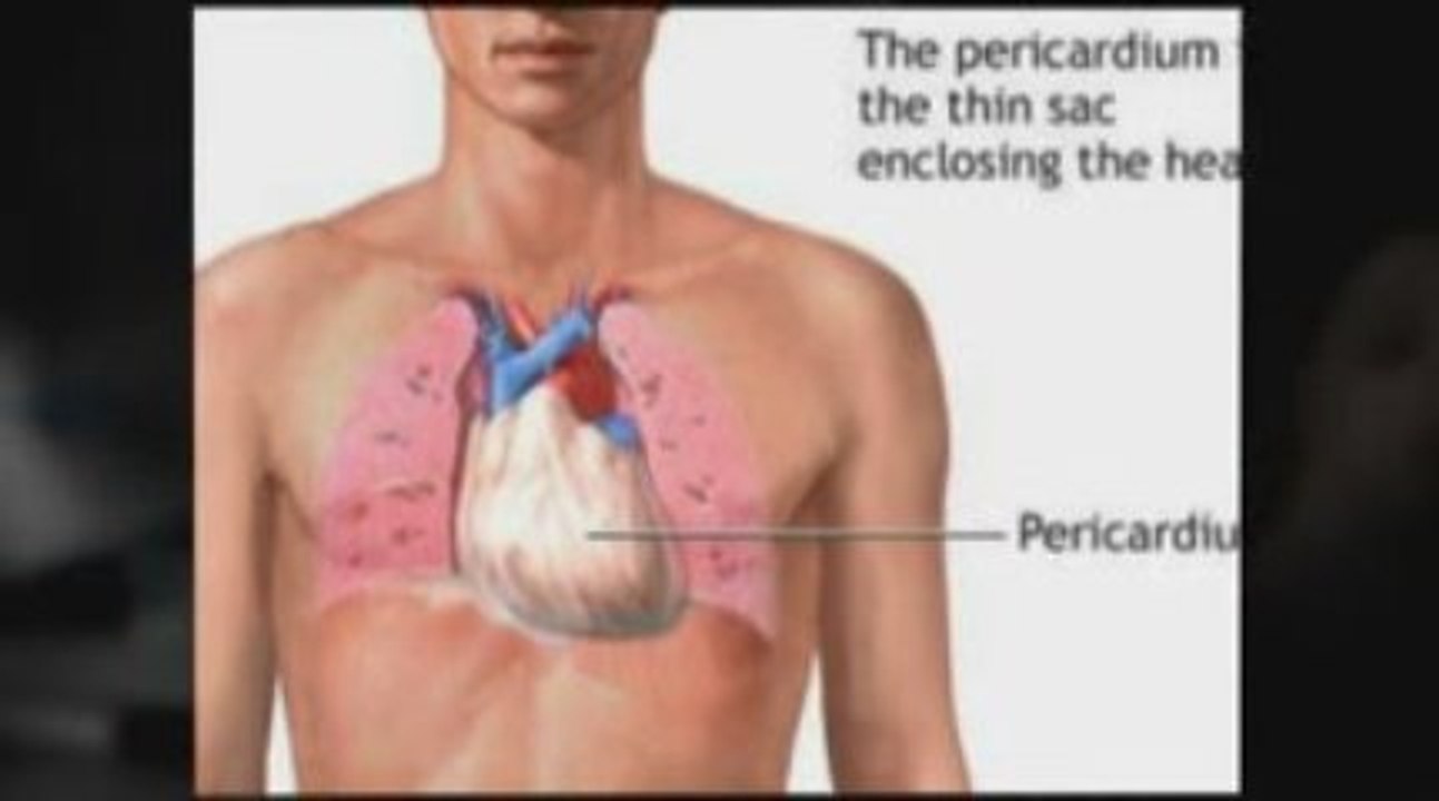Abilene, TX Mesothelioma Lawyer