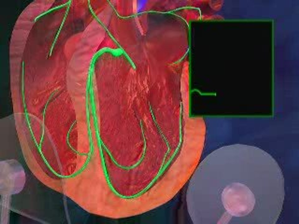 What Is an ECG