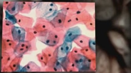 Provo, UT Mesothelioma Lawyer