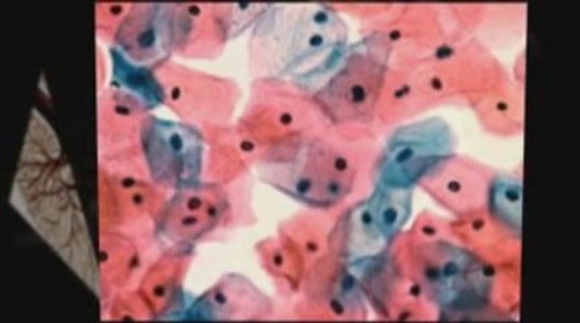 Salt Lake City, UT Mesothelioma Lawyer