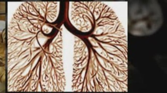 Salt Lake City, UT Mesothelioma Lawyer