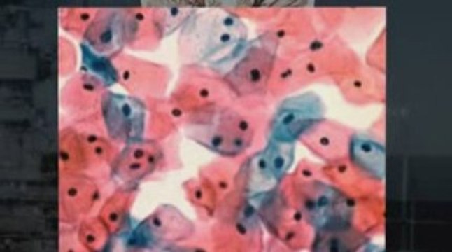 West Jordan, UT Mesothelioma Lawyer