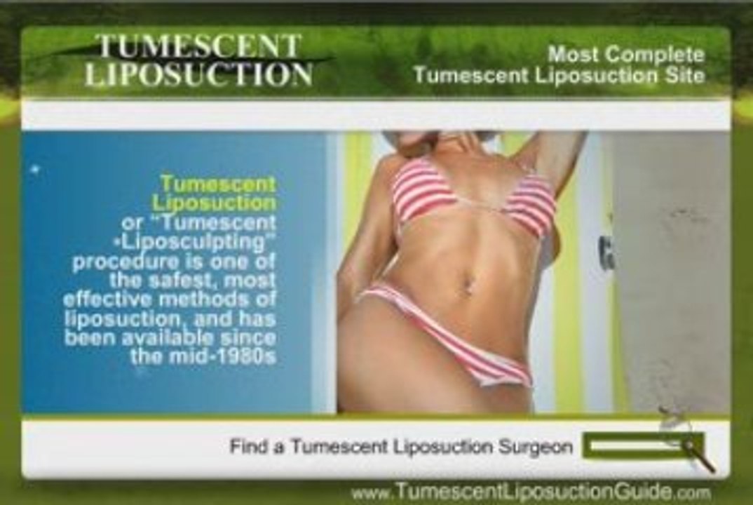 Tumescent Liposuction 06