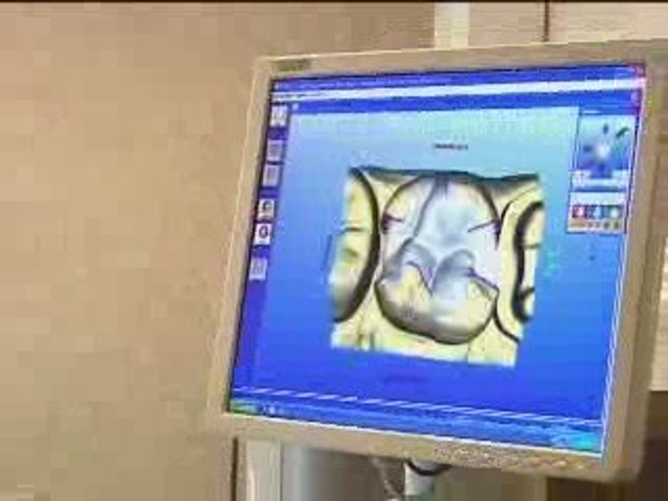 Ballantyne Center for Dentistry - CEREC Restorations