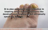 Treat Toenail Fungus Today with These Powerful Treatments