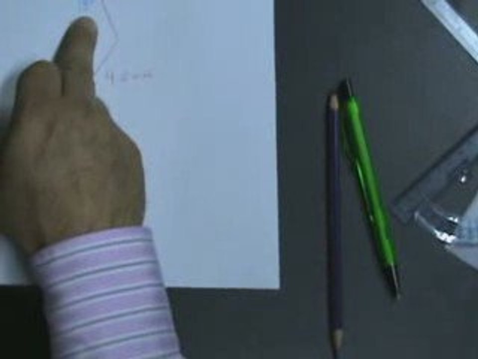 Set-up Ortodóncico 2º parte