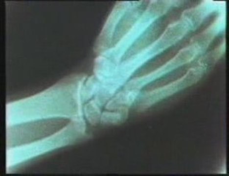 Movimiento: Musculos, huesos y articulaciones