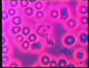 Sistema inmunitario: Cuerpo humano