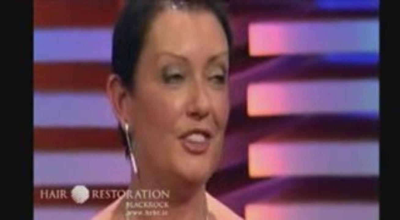 Hair Loss Discussion on Late Late Show Ireland - Part 3