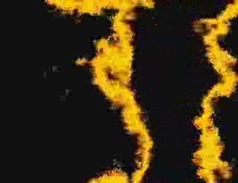 O.D.H Tv 3 Ans Remerciements