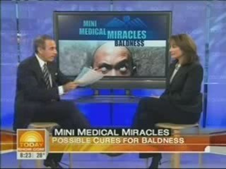 Hair Loss Product Reviews