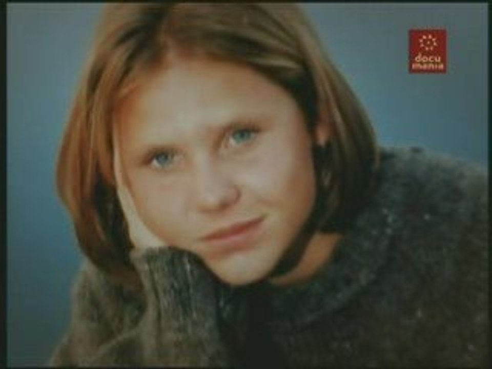 Trastornos alimentarios (1): Anorexia