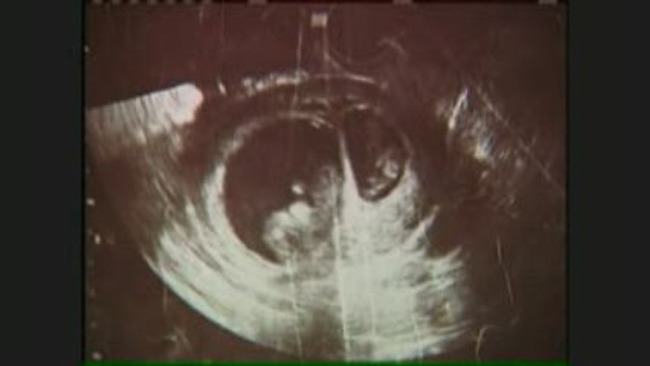Woman Pregnant With...