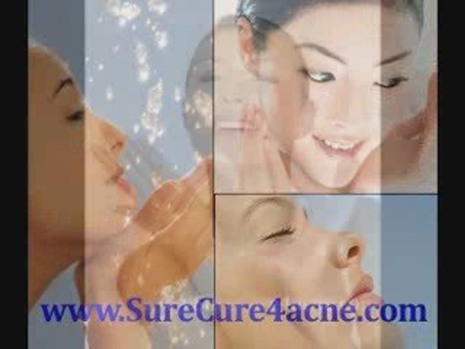 Does toothpaste work for pimples?