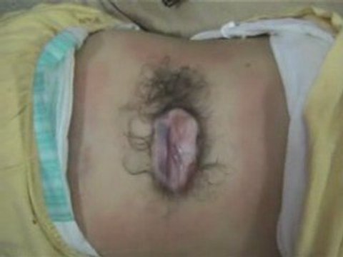 beni amrane walid sos boumerdes algerie médecin need help