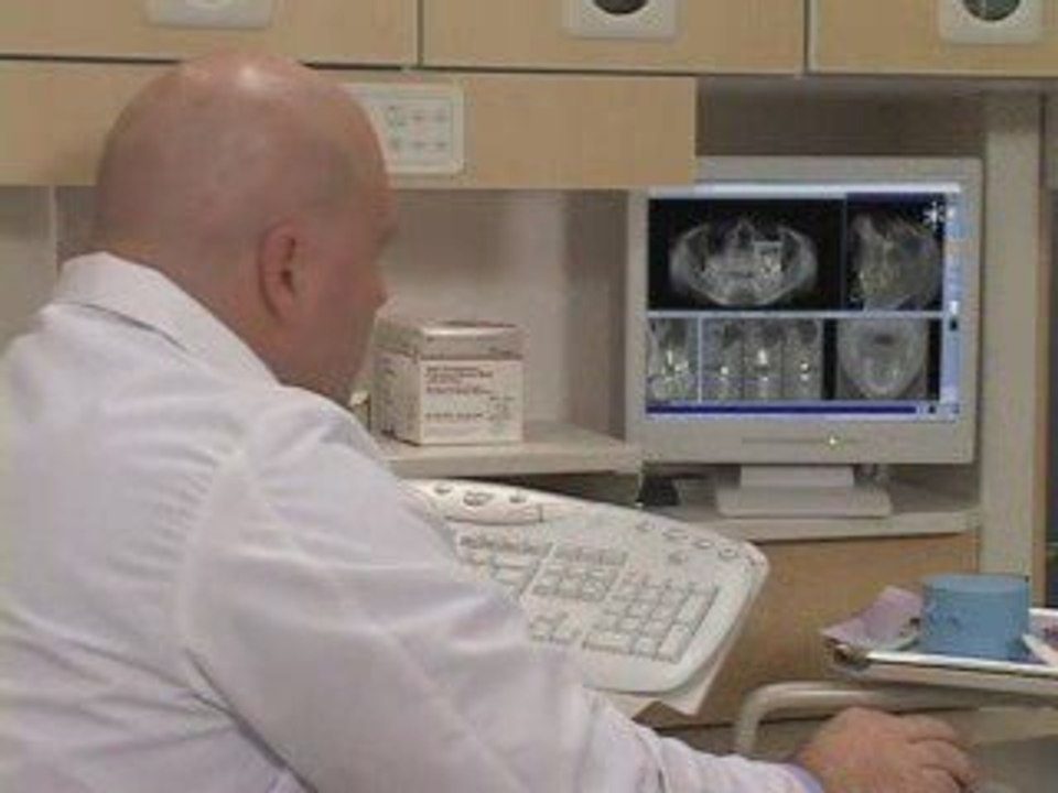 Implantes - Generalidades