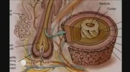 Dr. Maurice Collins from HRBR talks about Hair Loss - Part 1