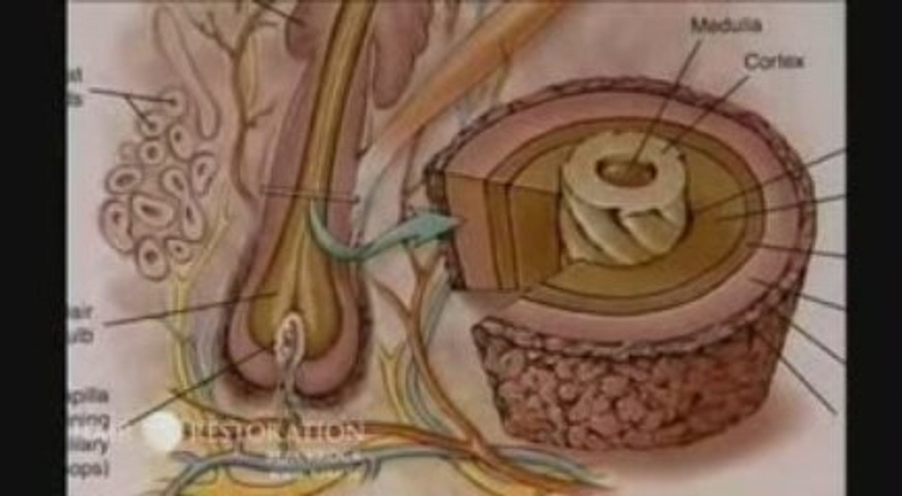 Dr. Maurice Collins from HRBR talks about Hair Loss - Part 1