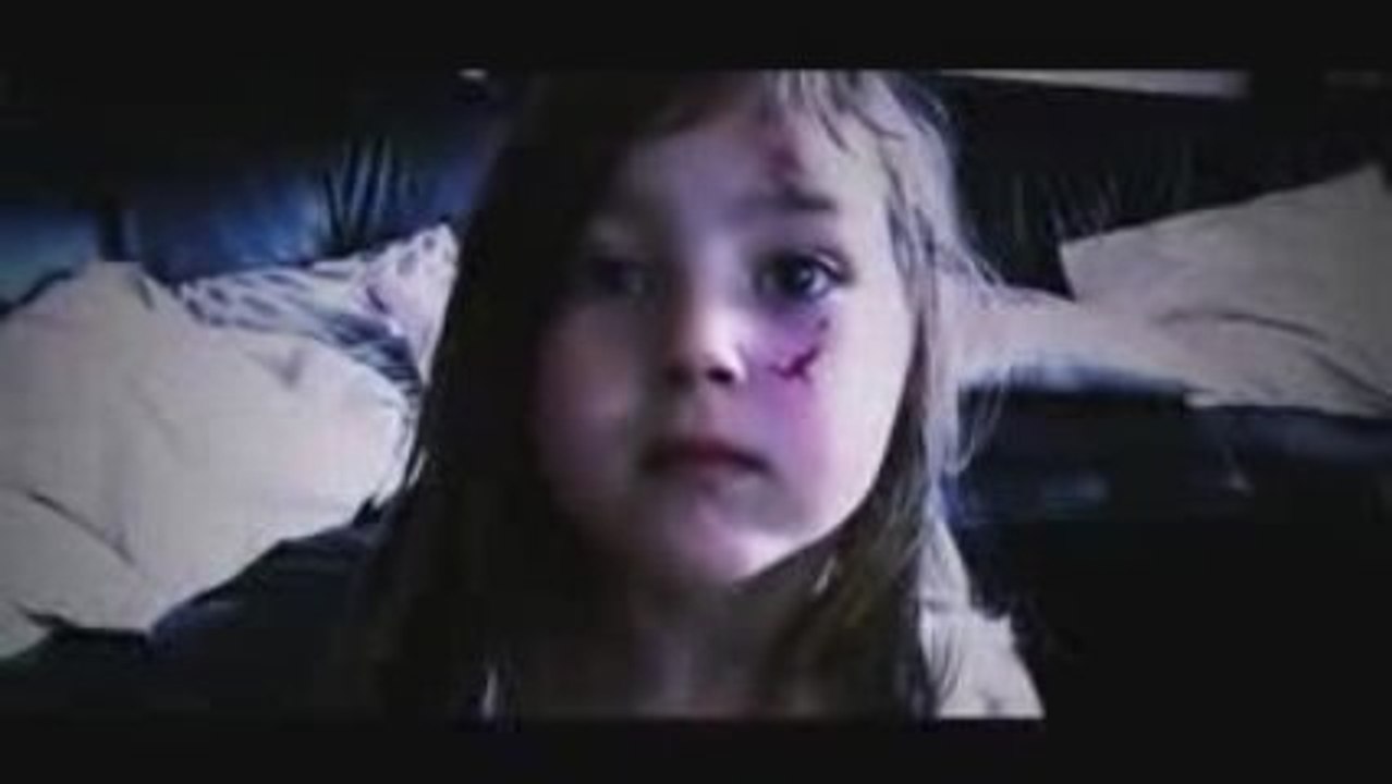 Emma apres une chute de velo