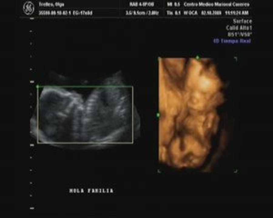 C'est une p'tit bonhomme