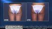 Dr. Galumbeck shows laser liposuction of the hips & thighs