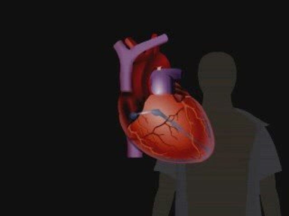 electrical pathaway of heart