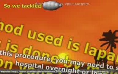 Various Treatment Options For Ovarian Cyst