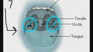 Alternative Tonsil Stones Tretament - Bad Breath Remedy