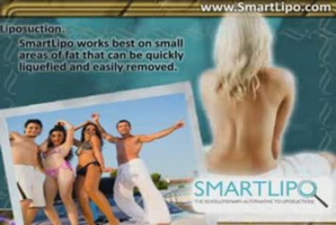 SmartLipo # 3