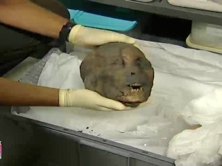 Exposition de la momie du Musée Bargoin