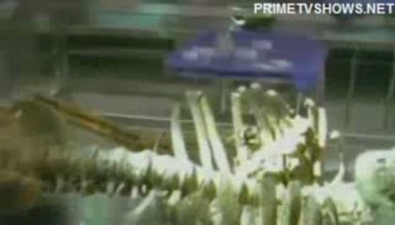 House Season 6 Episode 5 - Brave Heart - S06E05 - 6x05