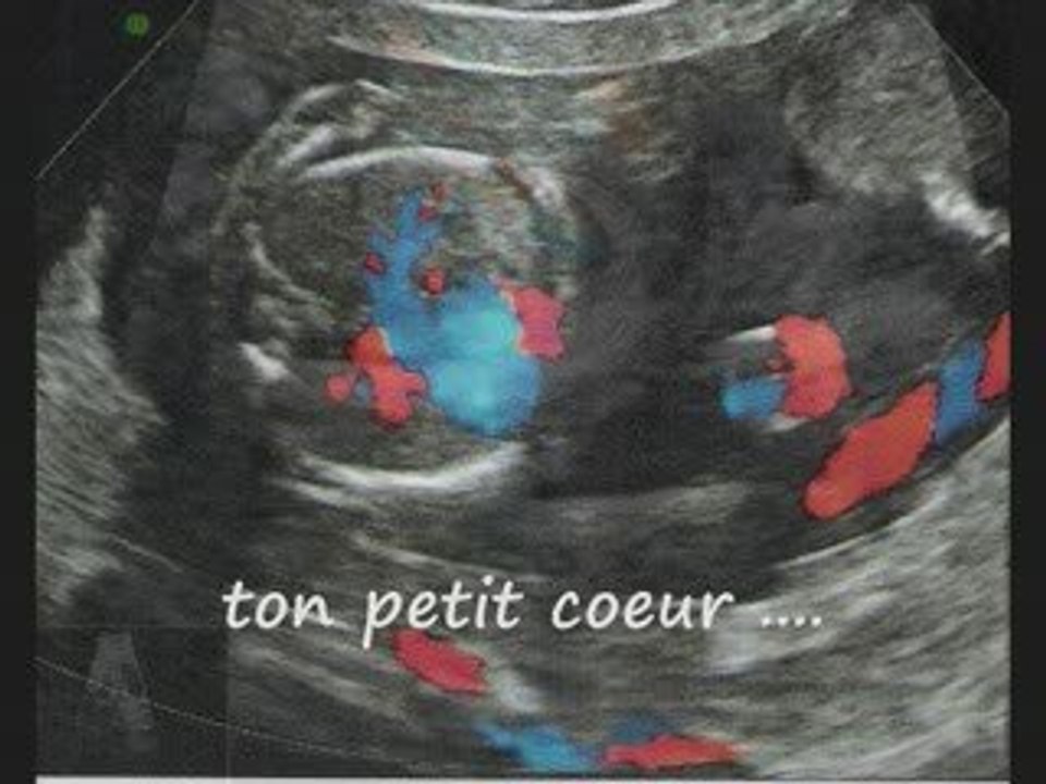 Théo, mon ange