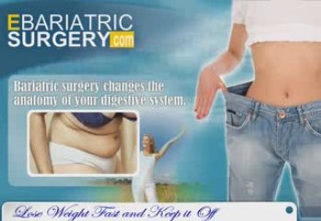 Bariatric Surgery No. 1