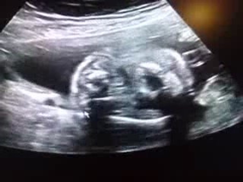 video de ma grossesse octobre 5 mois