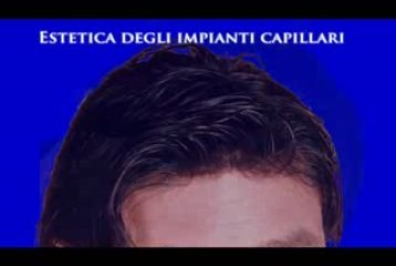 CENTRO INFOLTIMENTO CAPELLI  www.luigiuomo.com