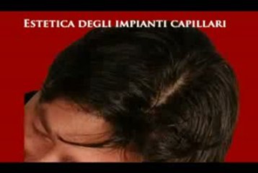 RICRESCITA CAPELLI   www.luigiuomo.com