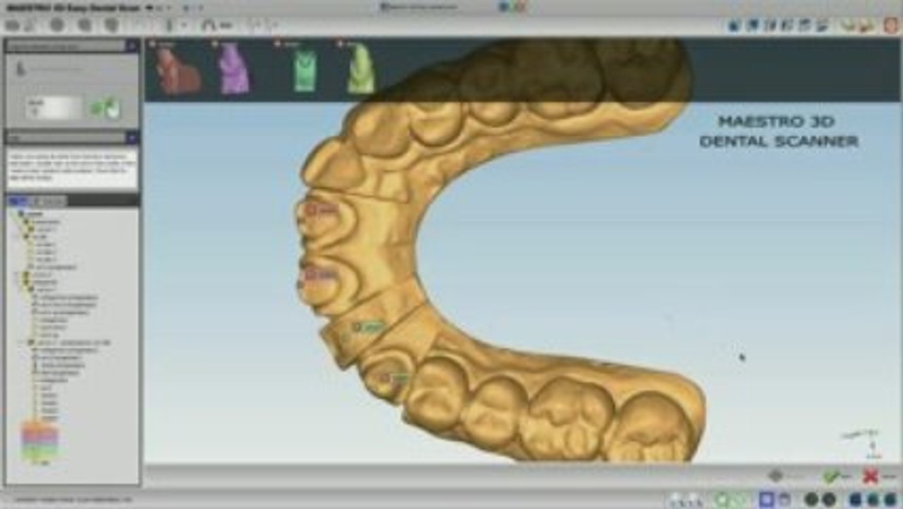 Maestro 3D Dental Scanner - www.maestro3d.com
