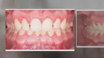 Ebert Orthodontics Treated Cases