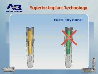 Présentation des produits AB Dental Devices