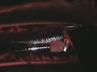 Weaver Ridge Blooper