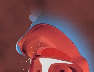 Allergy & Pathogenesis